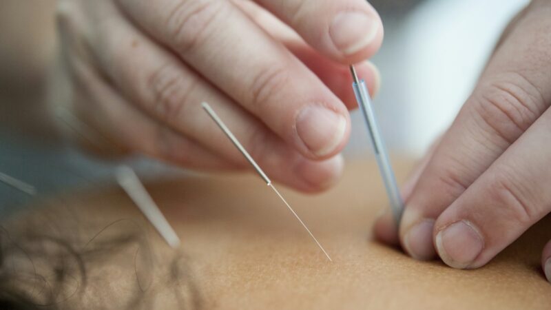 TCM and Acupuncture in Singapore