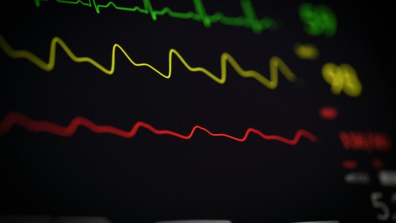 Understanding Your Resting Heart Rate